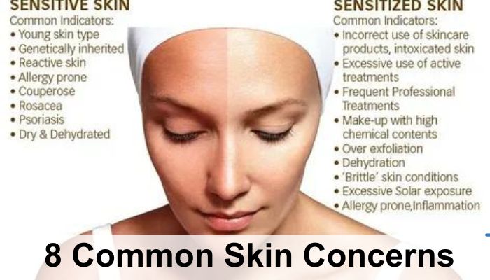 8 Common Skin Concerns