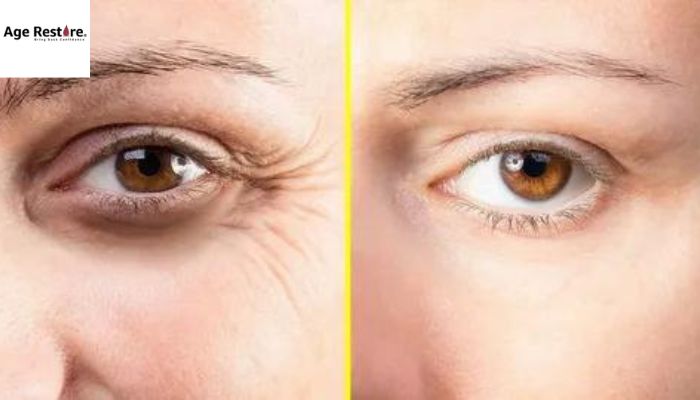 What To Do If You Hate Those Fine Lines Around Your