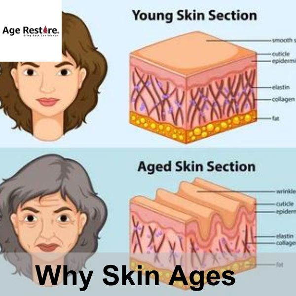 Why Skin Ages?